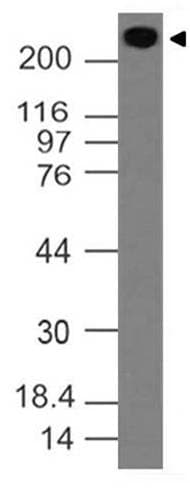 VWF / Von Willebrand Factor Antibody