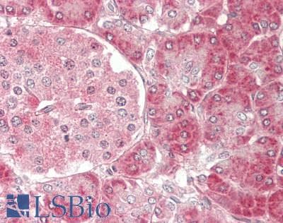 IHC-plus™ Polyclonal Rabbit anti-Human CDC42 Antibody (IHC, WB)