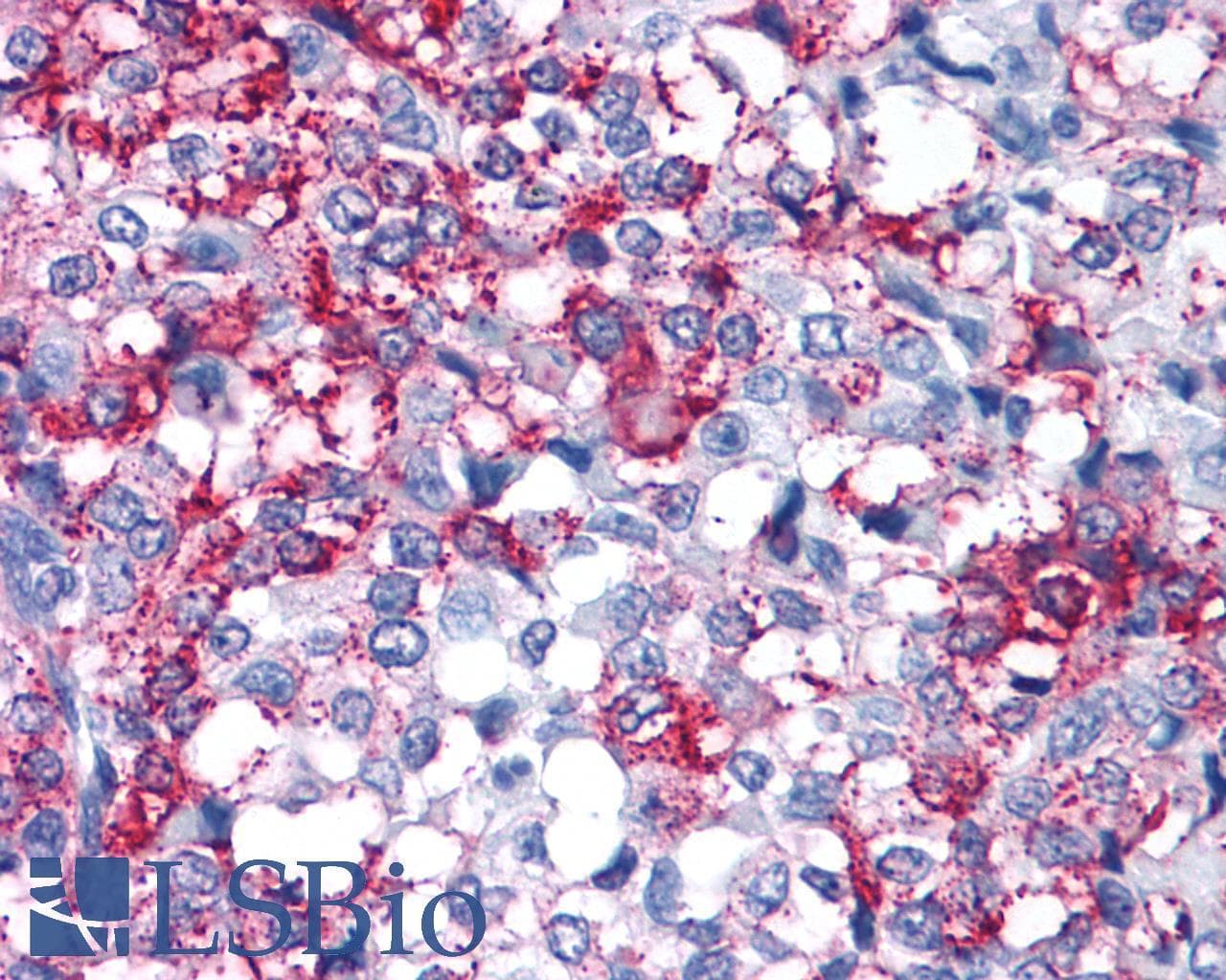 PathPlus™ Polyclonal Rabbit anti-Human FZD3 / Frizzled 3 Antibody (N-Terminus, IHC)
