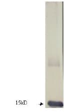 Dermatophagoides DERP1 Antibody (Preservative Free)