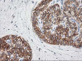 SNAP25 Antibody (clone OTI 1E6)