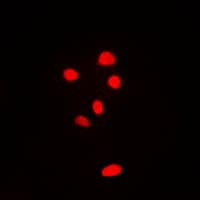 Polyclonal Rabbit anti-Human RPL11 / Ribosomal Protein L11 Antibody (C-Terminus, IF, WB)