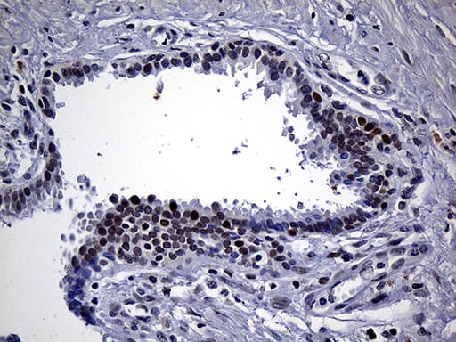SDCCAG1 / NEMF Antibody (aa869-1076, clone OTI7E10)