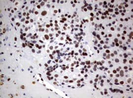 Monoclonal Mouse anti-Human FOXP1 Antibody (clone OTI3G3, IHC)