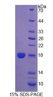 Human DUSP5 Protein (Recombinant His-T7)