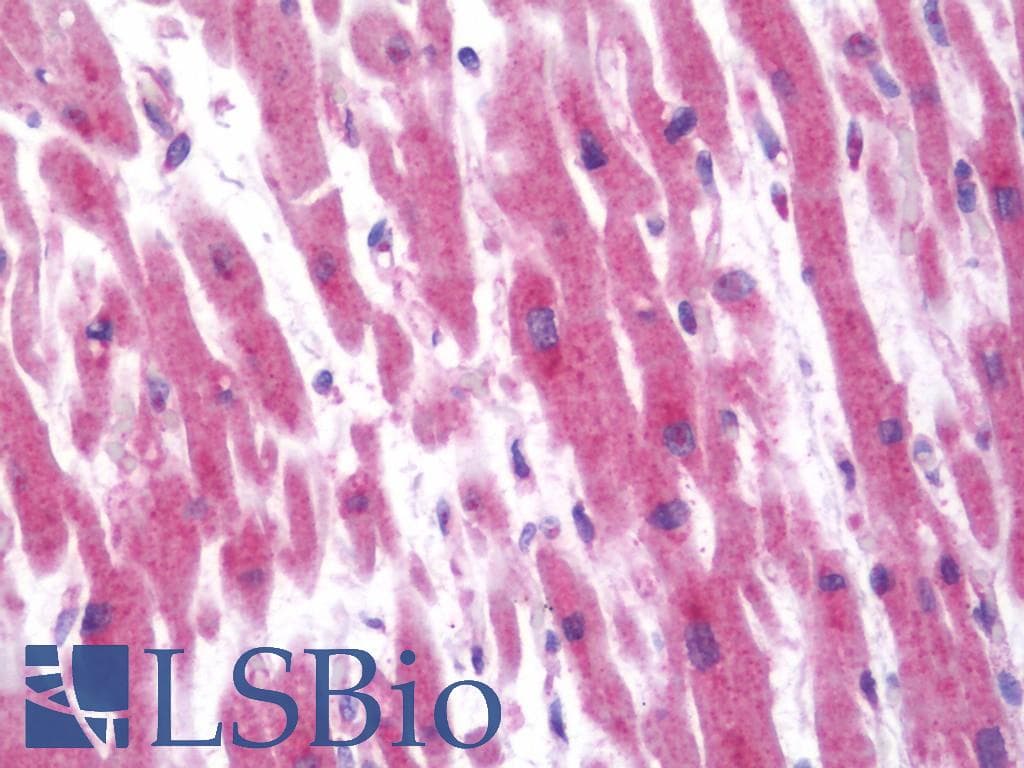 IHC-plus™ ALOX12 / 12 Lipoxygenase Antibody (aa618-650)