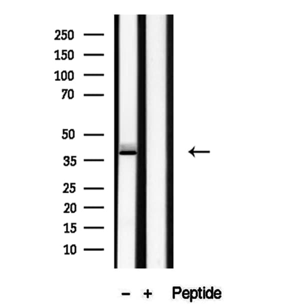 Polyclonal Rabbit anti-Human RBM4 / LARK Antibody (IHC, IF, WB)