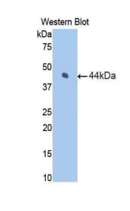 F7 / Factor VII Antibody (aa42-169)