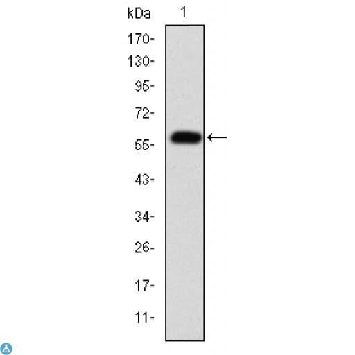 FGG / Fibrinogen Gamma Antibody