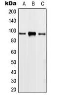 PLA2G4A Antibody (Internal)