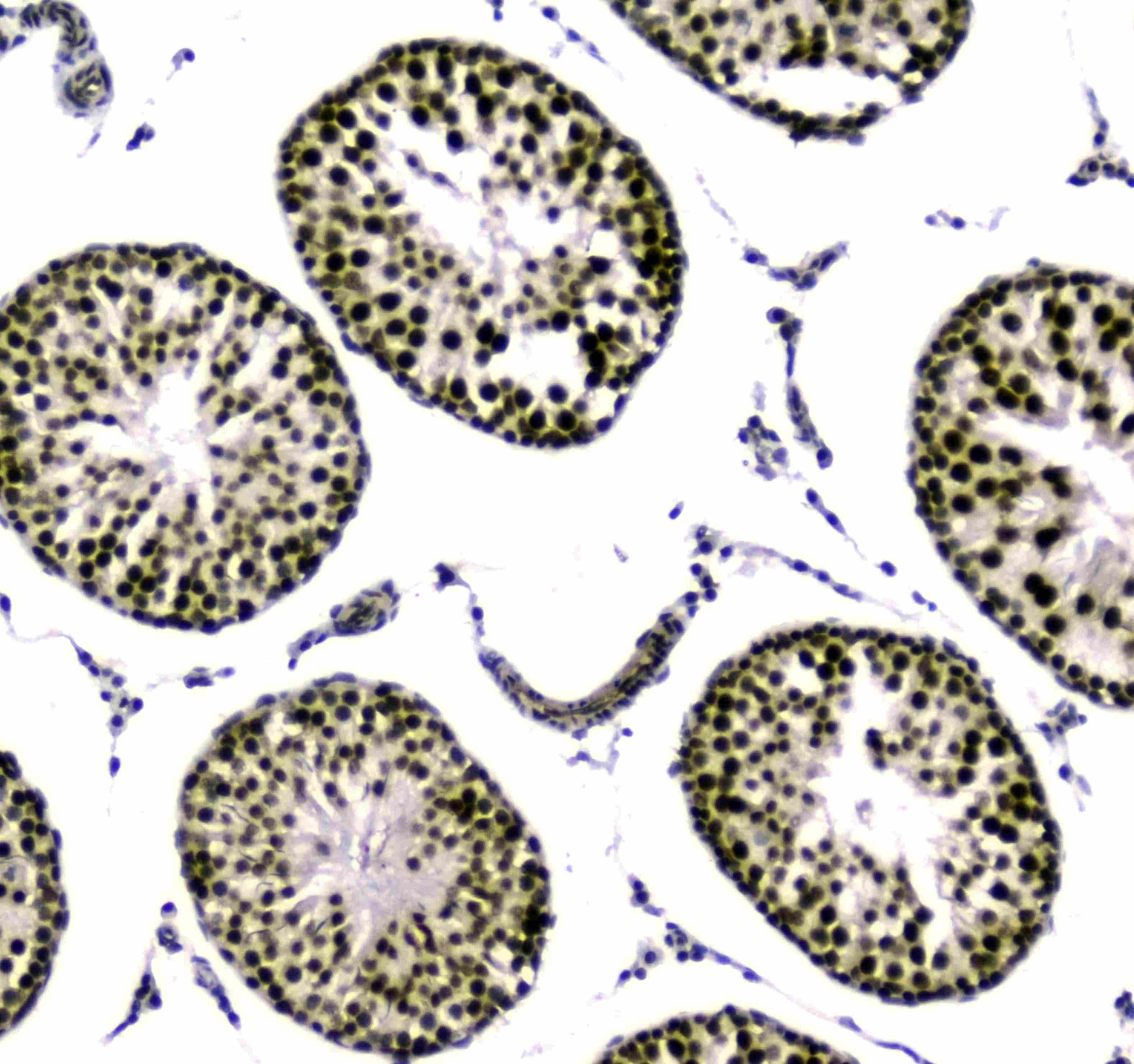 SAE2 / UBA2 Antibody