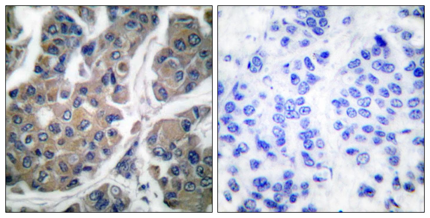 EEF2 / Elongation Factor 2 Antibody (phospho-Thr56)