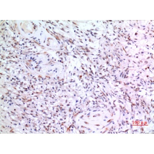 ZNF307 Antibody (Internal)