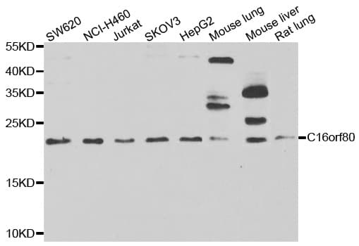 CFAP20 / GTL3 Antibody