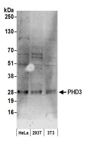 IHC-plus™ Polyclonal Rabbit anti-Human EGLN3 / PHD3 Antibody (aa50-100, IHC, WB)
