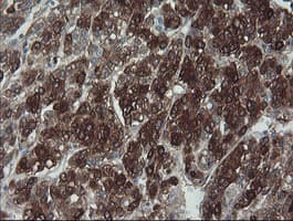 FTCD / 58K Golgi Protein Antibody (clone OTI8C2)