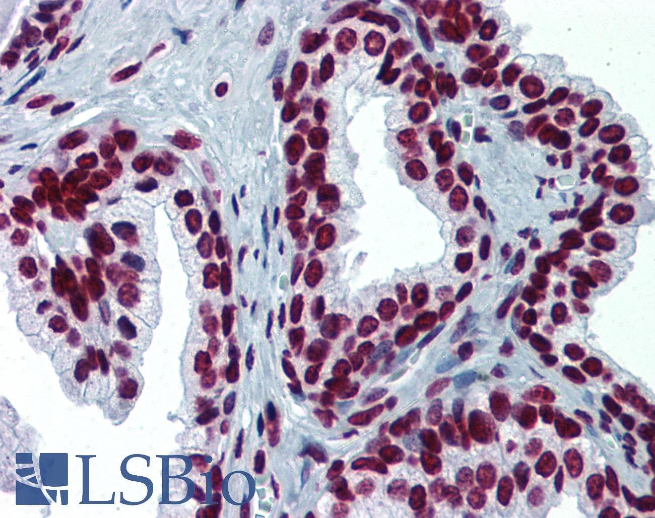 IHC-plus™ RPS6KA2 / RSK3 Antibody (clone 1F6)