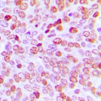 TBP / GTF2D Antibody (Internal)