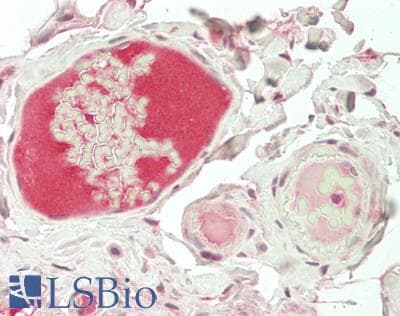IHC-plus™ RSPO1 / RSPO Antibody