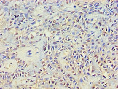 GRB4 / NCK2 Antibody (aa1-380)