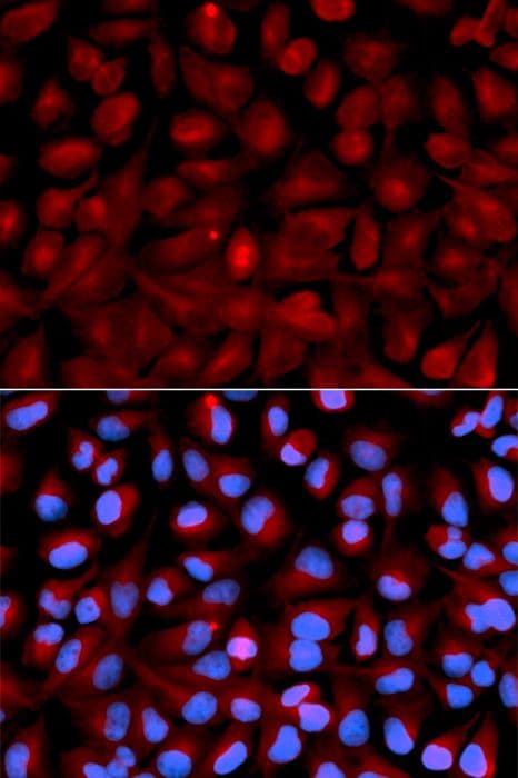 HDAC6 Antibody