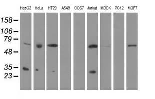 P5CR2 / PYCR2 Antibody (clone OTI2F11)