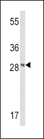 FXN / Frataxin Antibody (aa72-102)