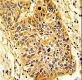 RIOK1 Antibody (aa126-156)
