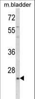 KLF16 Antibody (aa150-179)