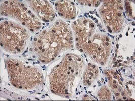 NUDT18 Antibody (clone OTI5F9)