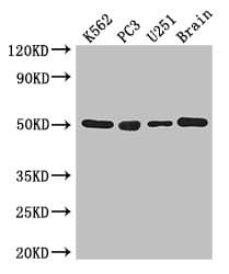 TUBA1C / Tubulin Alpha 1C Antibody