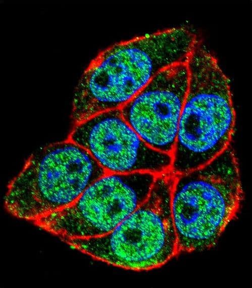 TRADD Antibody (aa126-151)