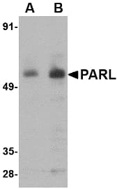 IHC-plus™ PARL / PSARL Antibody