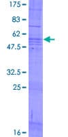 Human CMTM2 Protein (Recombinant GST)