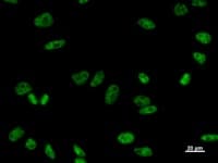 Monoclonal Mouse anti-Human PRPF8 Antibody (clone 2834C1a, IF, WB)