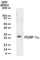 PGLYRP3 Antibody (aa178-193)