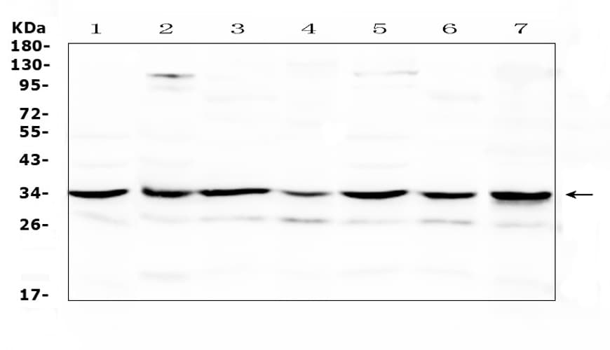 Polyclonal Rabbit anti-Human UCP2 Antibody (WB)