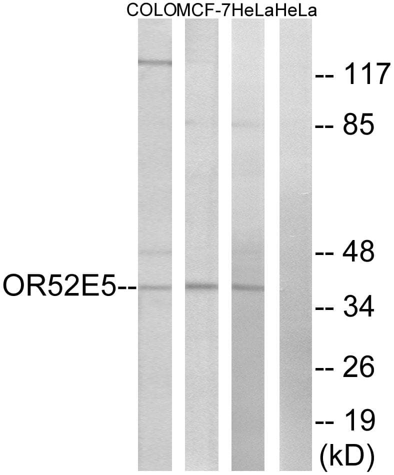 Polyclonal Rabbit anti-Human OR52E5 Antibody (WB)