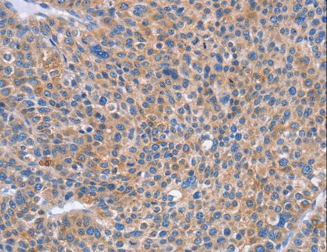 Polyclonal Rabbit anti-Human SIGLEC7 / CD328 Antibody (IHC, WB)