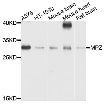 MPZ / P0 Antibody