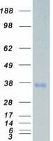 Human STK16 Protein (Recombinant Myc-DDK (Flag))