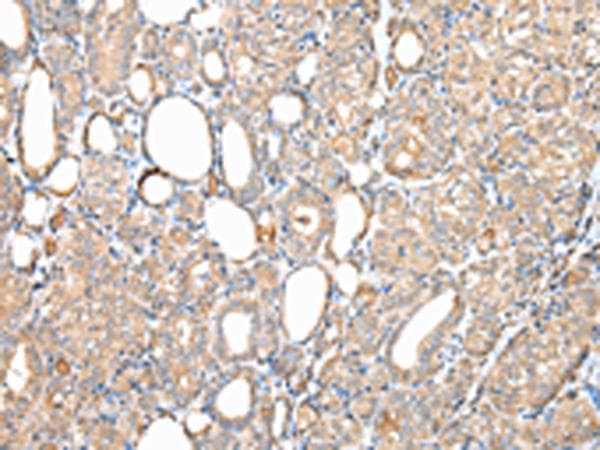 DPH7 / WDR85 Antibody
