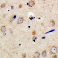Polyclonal Rabbit anti-Human PSMD11 Antibody (Internal, IHC, WB)