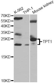 TPT1 / TCTP Antibody