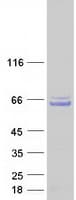 Human CCDC130 Protein (Recombinant Myc-DDK (Flag))