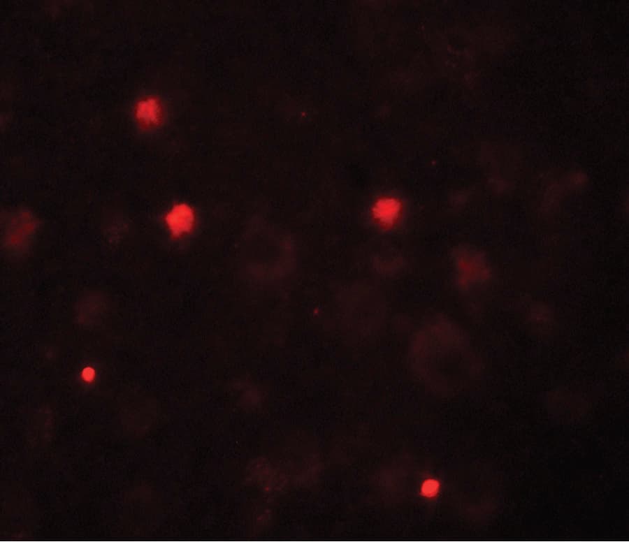 IHC-plus™ KCNK13 / THIK-1 Antibody