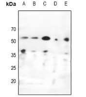 CHEK1 / CHK1 Antibody