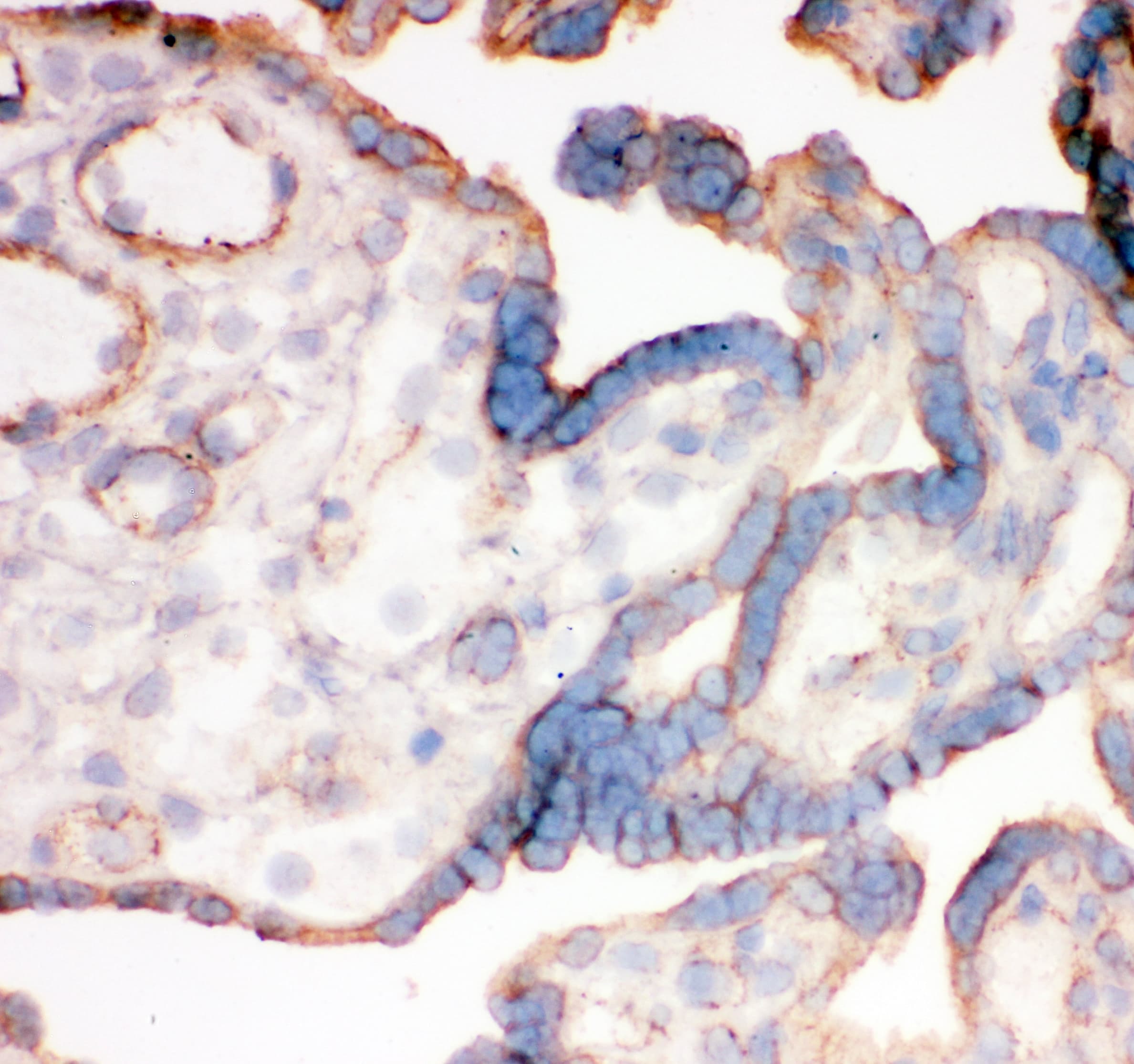 ITGA4 / VLA-4 / CD49d Antibody (aa999-1028)