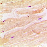 RRAD Antibody (Internal)