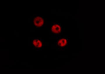 ZNF148 / ZBP-89 Antibody